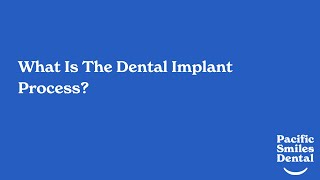 Dental Implants Explained: The Ultimate Solution for Missing Teeth