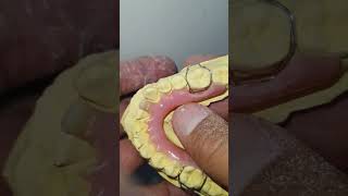 Denture repair beautyart prosthodontics bdsdds dmdmchs kuhes clinical smile health viral