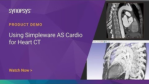 Using Simpleware AS Cardio for Heart CT | Synopsys