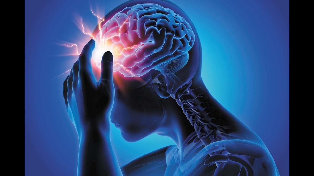 Demonstration of a Supraorbital Neuralgia Injection Treatment