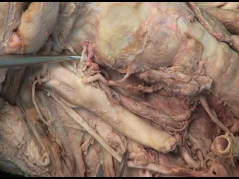 1.3 Step 9.   Right recurrent laryngeal nerve; superior laryngeal nerve and artery