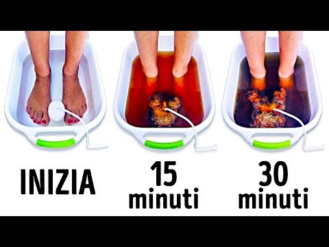 Video: Il Bagno Allo Zenzero Rimuove Le Tossine Dal Corpo E Ringiovanisce Il Corpo