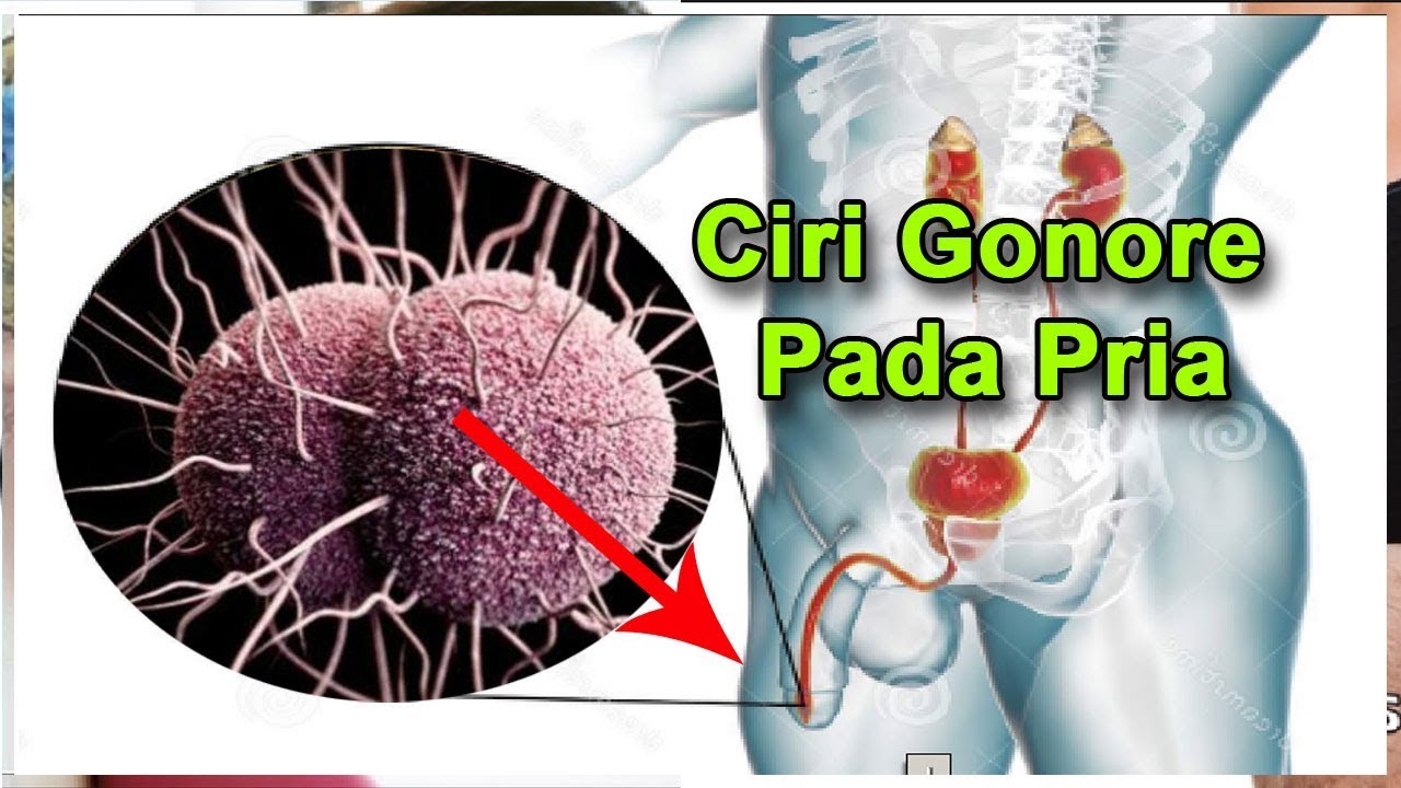 Ciri Gonore Pada Pria Yang Perlu Anda Ketahui 