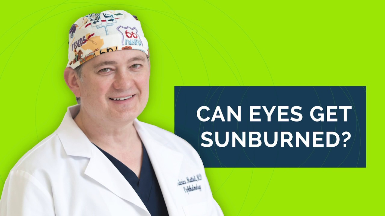 Can eyes get sunburned? [Ask Dr. Fred Mattioli] 