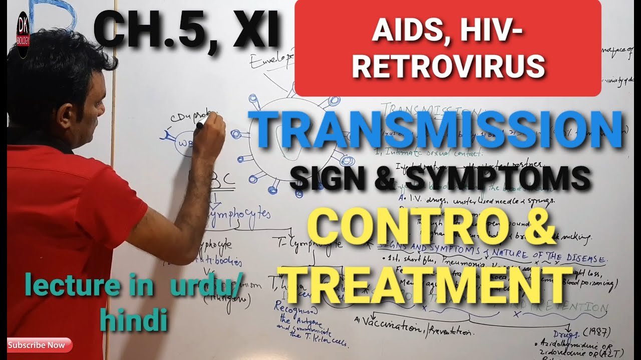AIDS,HIV-RETROVIRUS, SIGN & SYMPTOMS, TRANSMISSION, CONTOL, PREVENTION ...