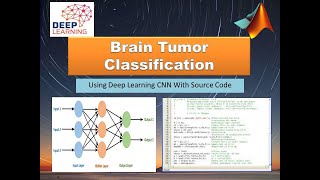 Brain Tumor Classification Using Deep Learning CNN With Source Code | Matlab Project Brain Tumor
