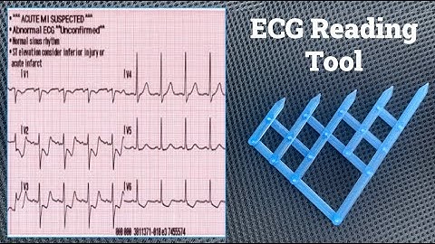 3D Printed ECG Tool