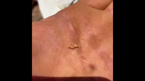 20" x-coils spiral for MINELAB GPZ7000