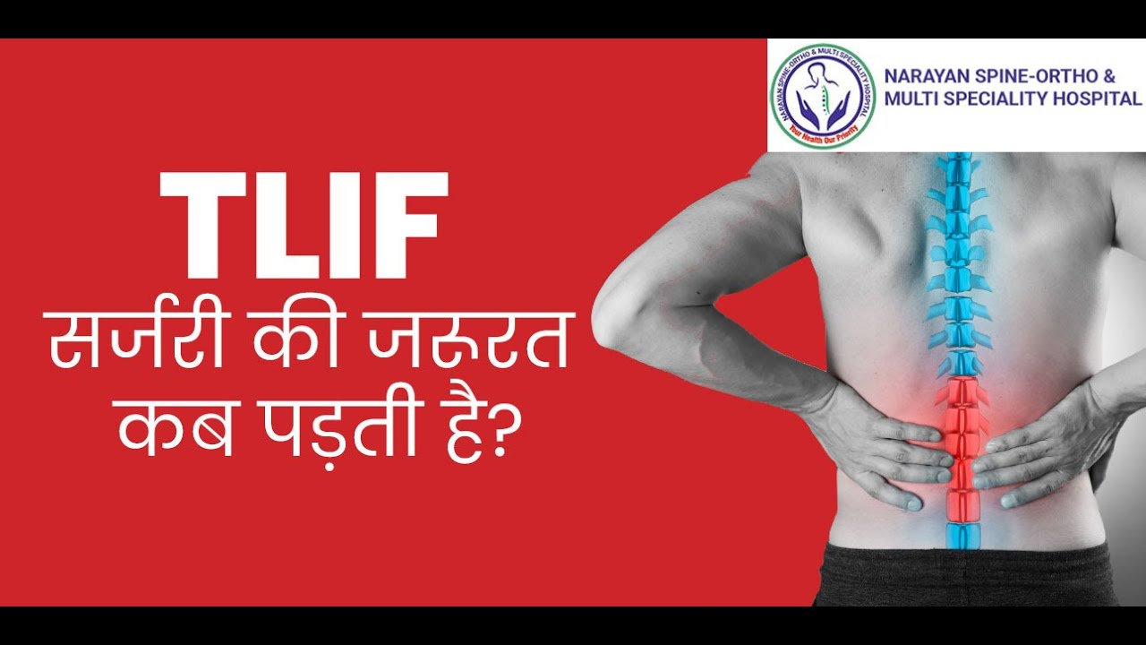 What is Transforaminal Lumbar Interbody Fusion Surgery 👨‍⚕️😷, When is it done and how is it done?👍