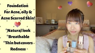 Foundation for Oily, and Acne scarred skin