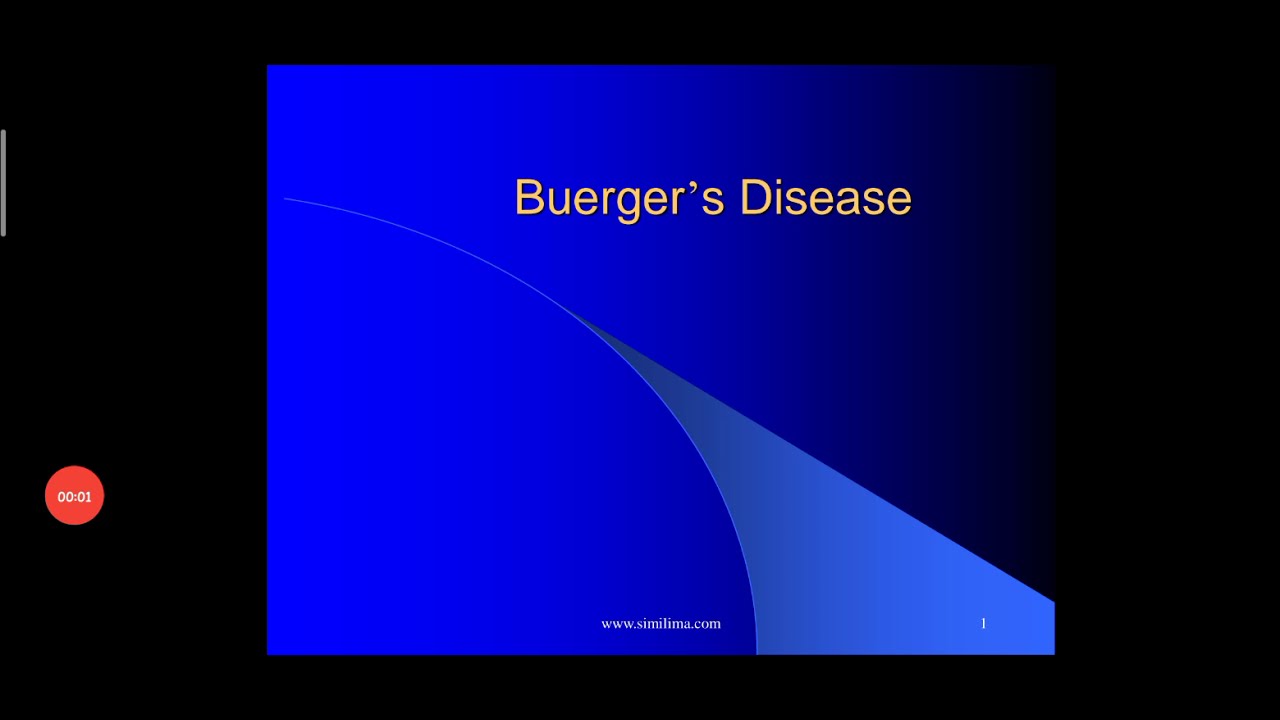 Buerger's disease , easy hindi explanation, pathology topic YouTube