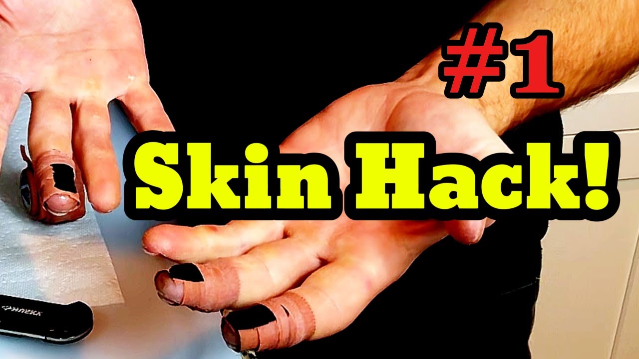 Rubber Tips: Cheating or Genius? Climb on Despite Your Wrecked Skin!