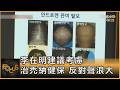 掉髮危機 儼然國家大事 南韓社群熱話題｜方念華｜FOCUS全球新聞20260519 @TVBSNEWS01