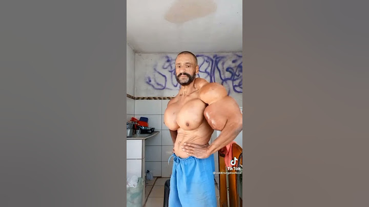 Real Life Hulk 🧟‍♂️ Freak Bodybuilder 😱 Whoe injects Synthol 💉