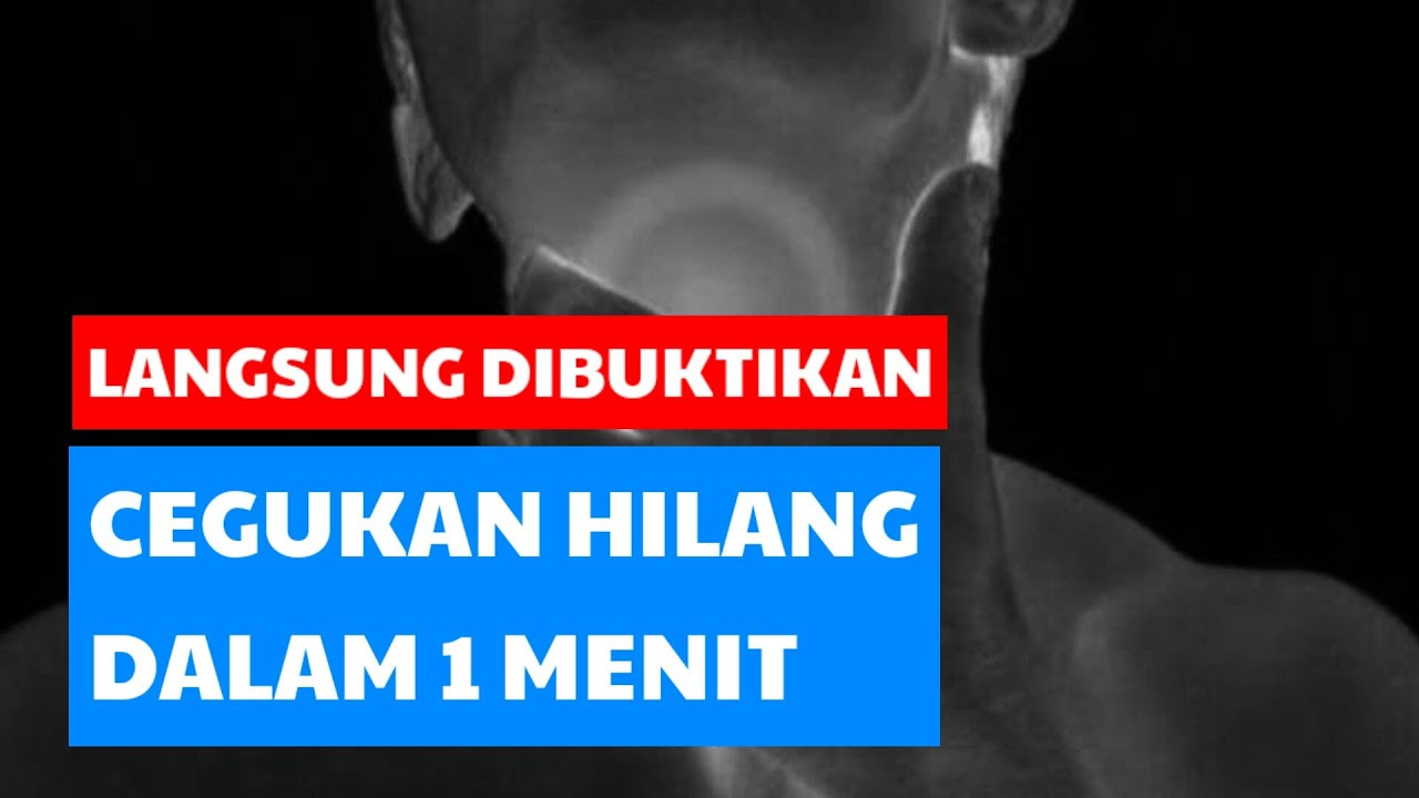 Cegukan hilang dalam semenit | Cara Ampuh Mengobati Cegukan 