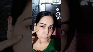 Acupressure For Weak Eyesight#acupoints #shorts
