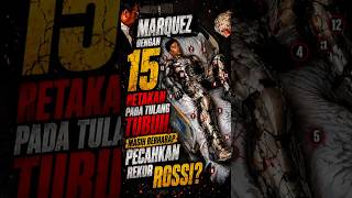 Kamus Cedera Mengerikan Marquez Bukti Mentalitas The Alien yang Melawan Batas Medis! #marcmarquez