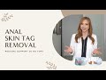 Let’s Talk About Anal Skin Tag Removal