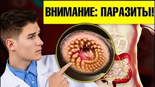 7 признаков наличия паразитов. Натуральные средства от паразитов👍