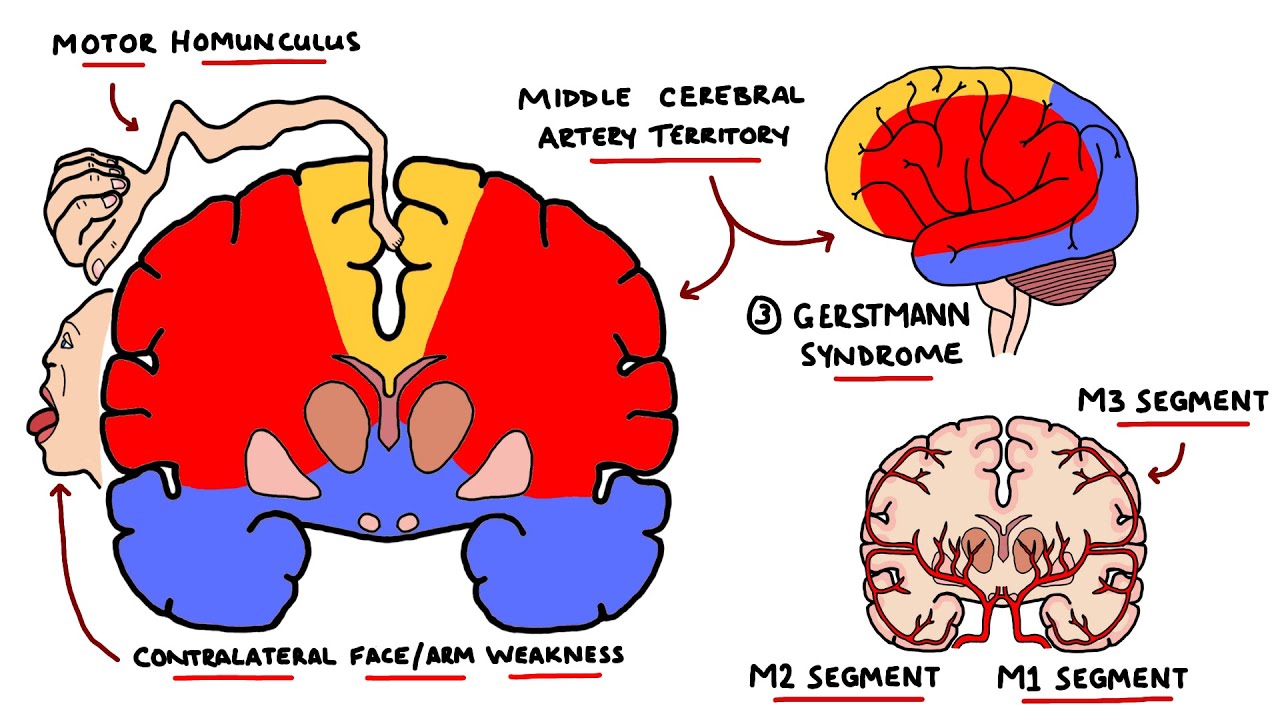 Cerebral Artery Occlusion Pathophysiology - mapasgmaes