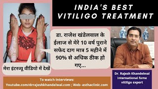 Successful Vitiligo Treatment | 10 वर्ष पुराने सफेद दाग ठीक हुए | Online Skin Disease Consultation