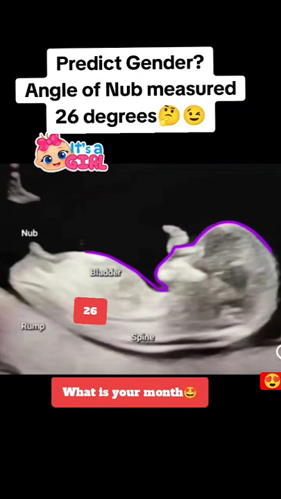 Predict gender angle of nub measured 26 degrees shows😋|#pregnancy #baby