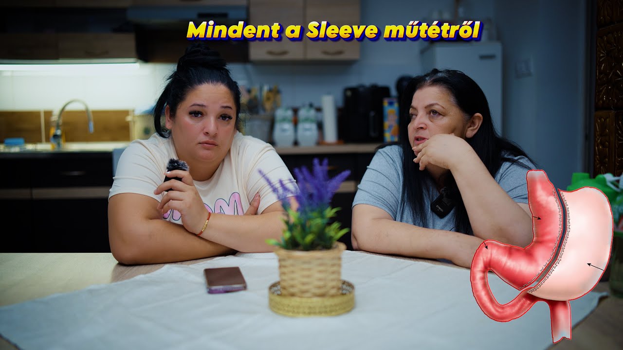 Sleeve műtét - Rita néni őszintén mesél
