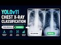 Chest X-Ray Classification using YOLOv11 | Pneumonia vs Normal Detection | Full Tutorial