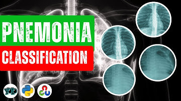 Chest X-Ray Classification using YOLOv11 | Pneumonia vs Normal Detection | Full Tutorial