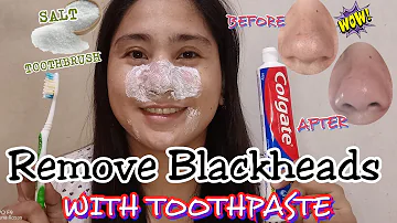 How do you use toothpaste to remove blackheads?