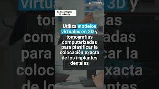 Implantes dentales con cirugía guiada | Dr. Juan Dopico