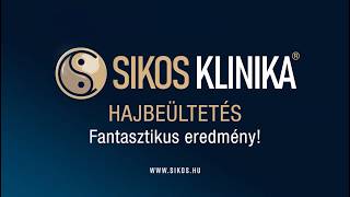 Fantasztikus hajbeültetés eredmény, Sikos Klinika!