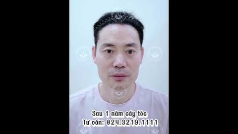 CẤY TÓC TỰ THÂN SAU 1 NĂM TRẺ RA 10 TUỔI LÀ CÓ THẬT NHA