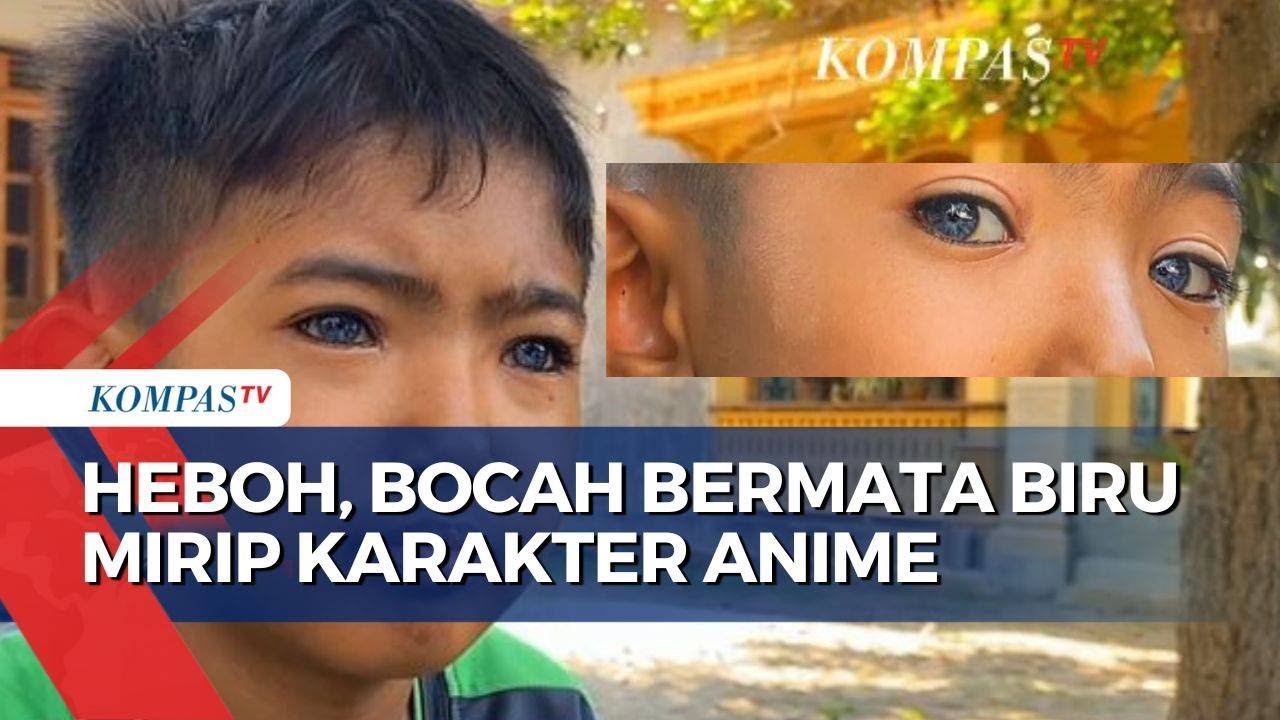 Unik! Seorang Bocah di Madiun Miliki Warna Mata Biru Seperti Karakter Anime