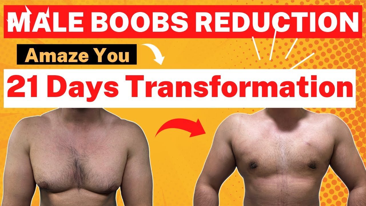 Gym Trainer's Transformation | Male Boobs reduction | Liposuction ...