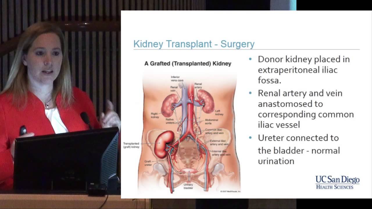 5TH Annual Update In Abdominal Transplantation Kidney Transplantation