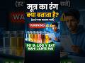 Urine Ka Color Health Ke Baare Me Kya Batata Hai #shorts #medicalfacts #pharmacist #healthtips