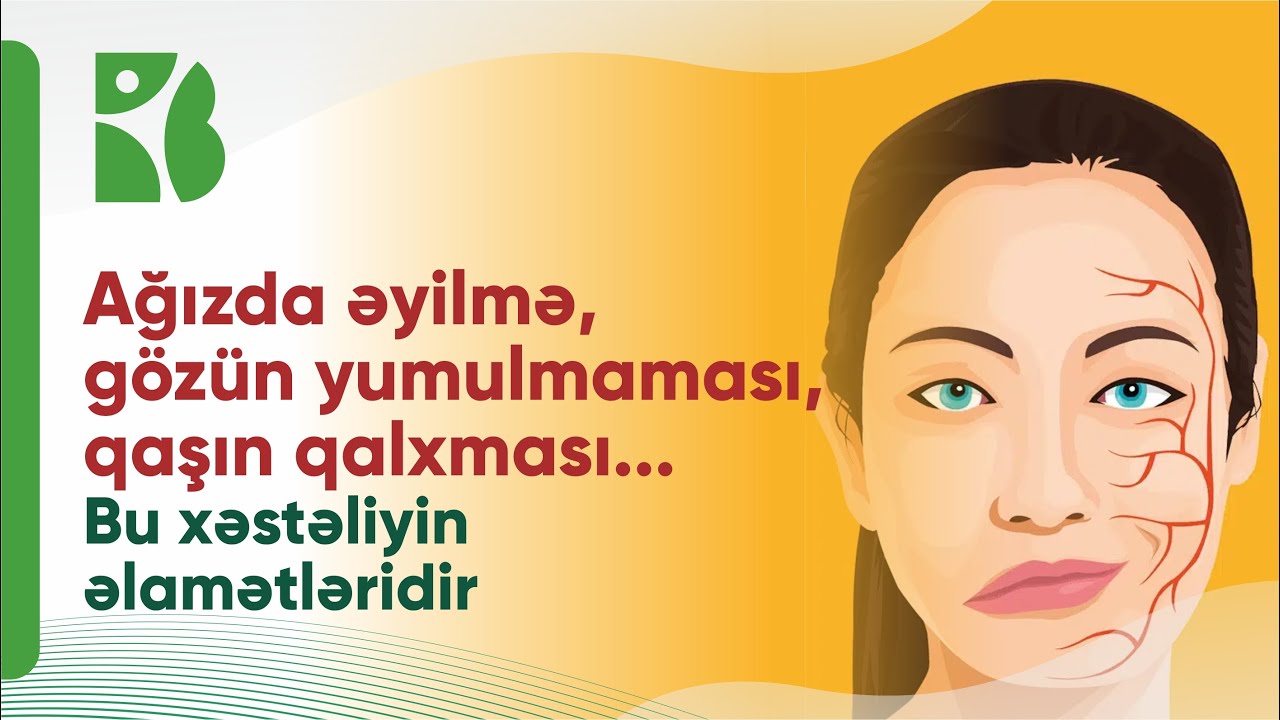 Üz sinirinin zədələnməsinin qarşısını almaq mümkündürmü? Müalicə üsulları hansılardır? Klinik hallar