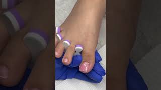 Acrylic application on big toe🤍✨🫧💕 #acrylictoes #nails #pedicure #nailtech #nailtutorial