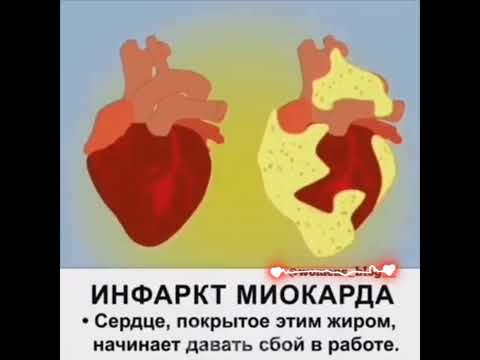 ‼️ВИСЦЕРАЛЬНЫЙ ЖИР‼️