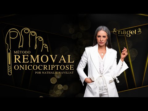 ผลสลากกินแบ่งรัฐบาล วันที่ 1 พย. 2567