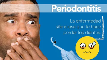 ¿Qué enfermedad hace perder los dientes?