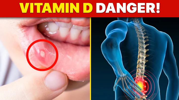 10 Warning Signs of Vitamin D Deficiency You Should Never Ignore