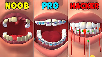 NOOB vs PRO vs HACKER - Perfect Smile 3D