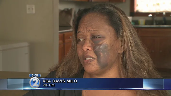 Woman brutally beaten in own home, sharing her story to warn others