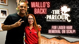 WALLO FLIES TO MIAMI FOR BALD SCALP LASER HAIR REMOVAL CLEAN SMOOTH LOW MAINTENANCE