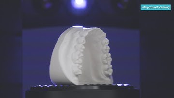 Interproximal Scan