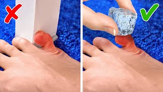 EMERGENCY HACKS FOR ALL OCCASIONS || First-Aid Tips For Smart Parents