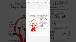 SUBCLAVIAN STEAL SYNDROME