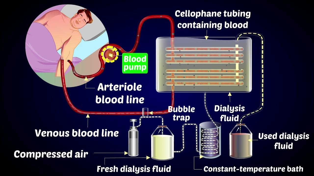 how-a-dialysis-machine-works-dialysis-artificial-kidneys-youtube